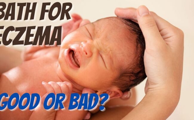 do baths make baby eczema worse